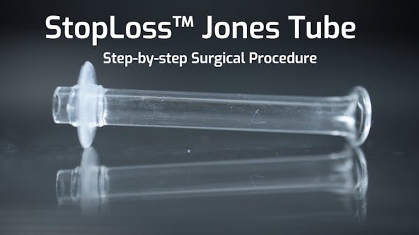 StopLoss™ Jones Tube: Step-by-Step Surgical Procedure thumbnail