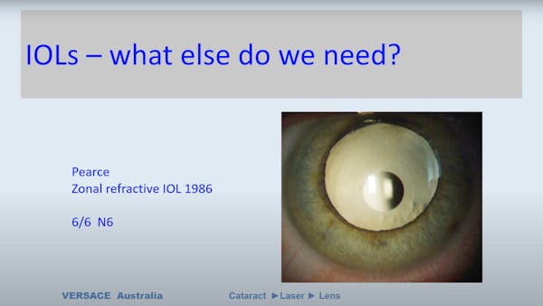 ALLY & FEMTIS® IOL: Highest Demands & Excellent Results thumbnail