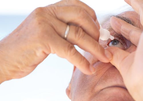 Tolerability and Adherence in the Management of Glaucoma and OHT image