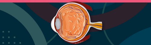 Best Practices On Referring Patients With Symptomatic Vitreous Opacities image