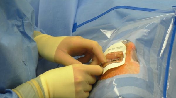Fully Immersive Phacoemulsification Procedure with Dr. Eva Liang thumbnail