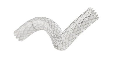 Gore Initiates VBX FORWARD Study Comparing Viabahn VBX Stent Graft to ...