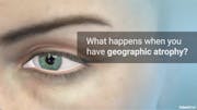 What is Geoatrophy?