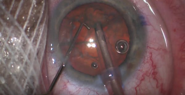 Horizontal Chop Techniques thumbnail
