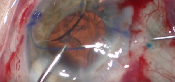 Trailing-Haptic-First Yamane Technique thumbnail
