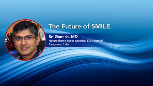 The Future of SMILE