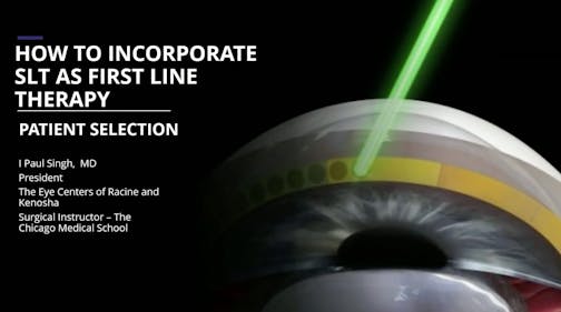 SLT as a First-Line Treatment: Which Patients Are Likely to Benefit the Most