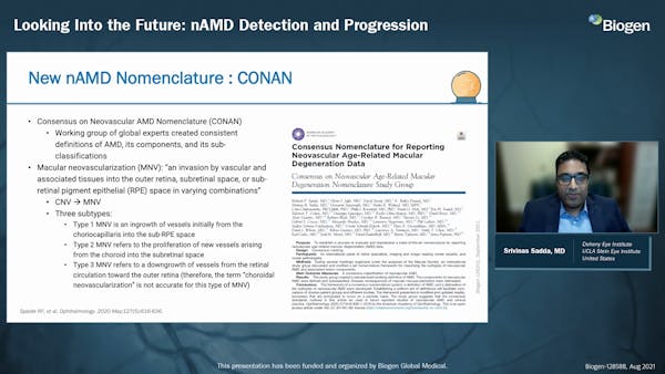 Imaging in AMD thumbnail