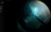 Dislocated Lens & Retinal Detachment
