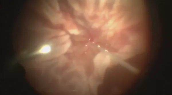 Trauma thumbnail