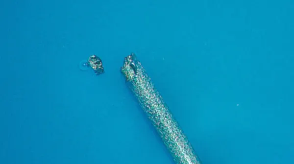 Foreign Body thumbnail