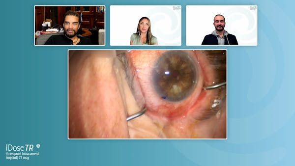 iDose TR® Live Procedure Broadcast thumbnail