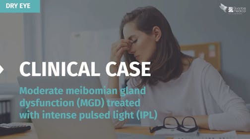 Clinical Case: Moderate Meibomian Gland Dysfunction Treated with Intense Pulsed Light (IPL)