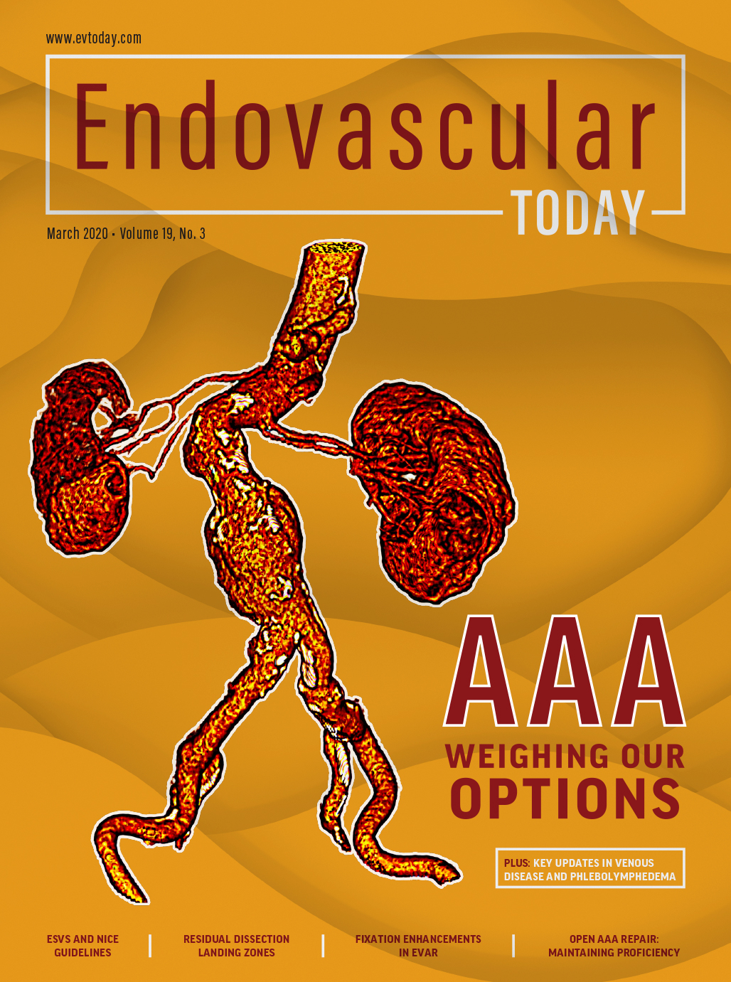 Duplex Ultrasound Technical Considerations For Lower Extremity Venous ...