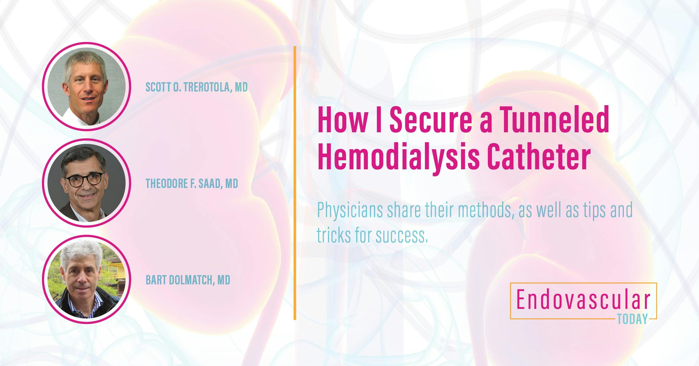 How I Secure a Tunneled Hemodialysis Catheter Endovascular Today