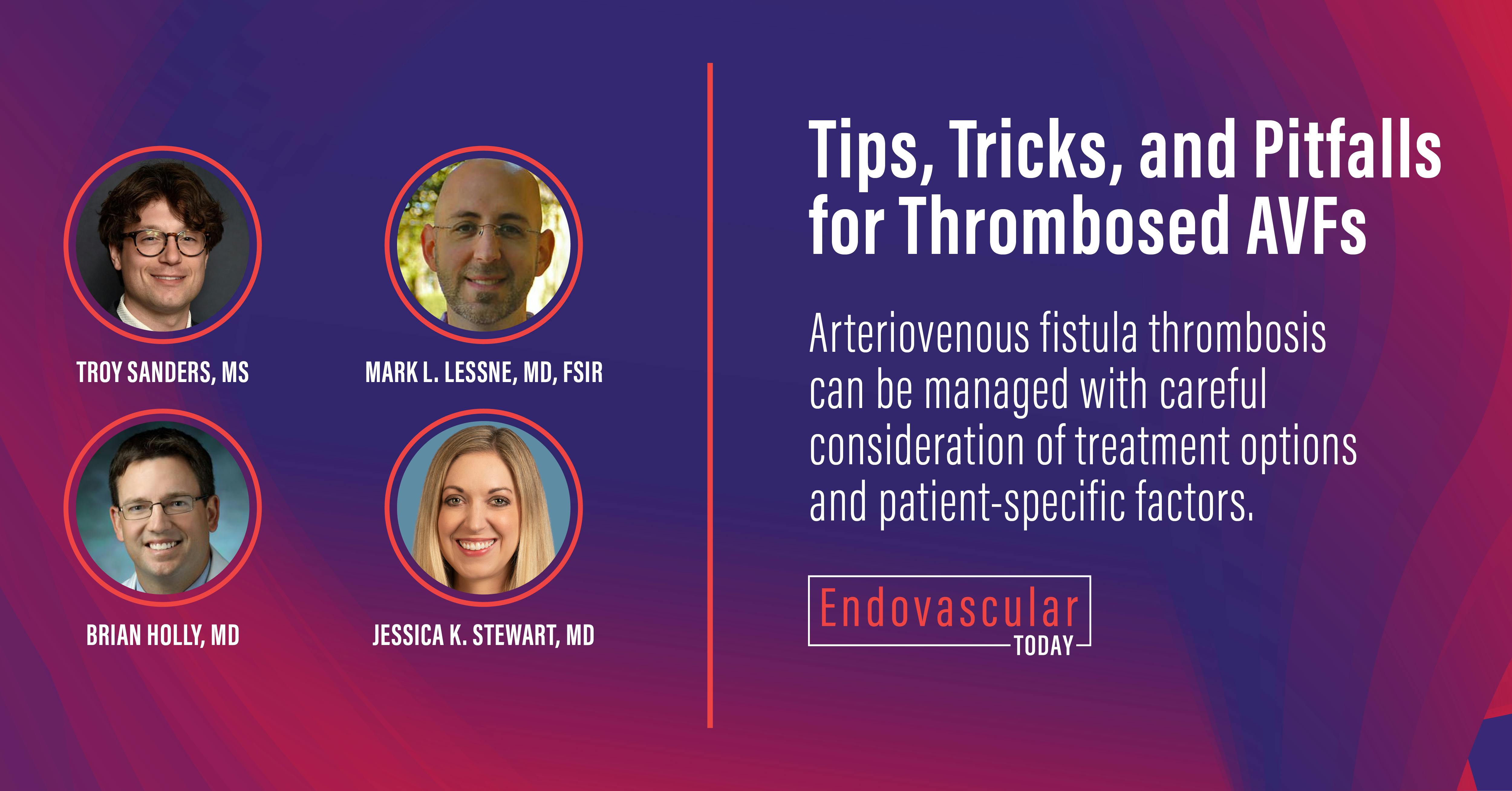 Tips, Tricks, and Pitfalls for Thrombosed AVFs - Endovascular Today