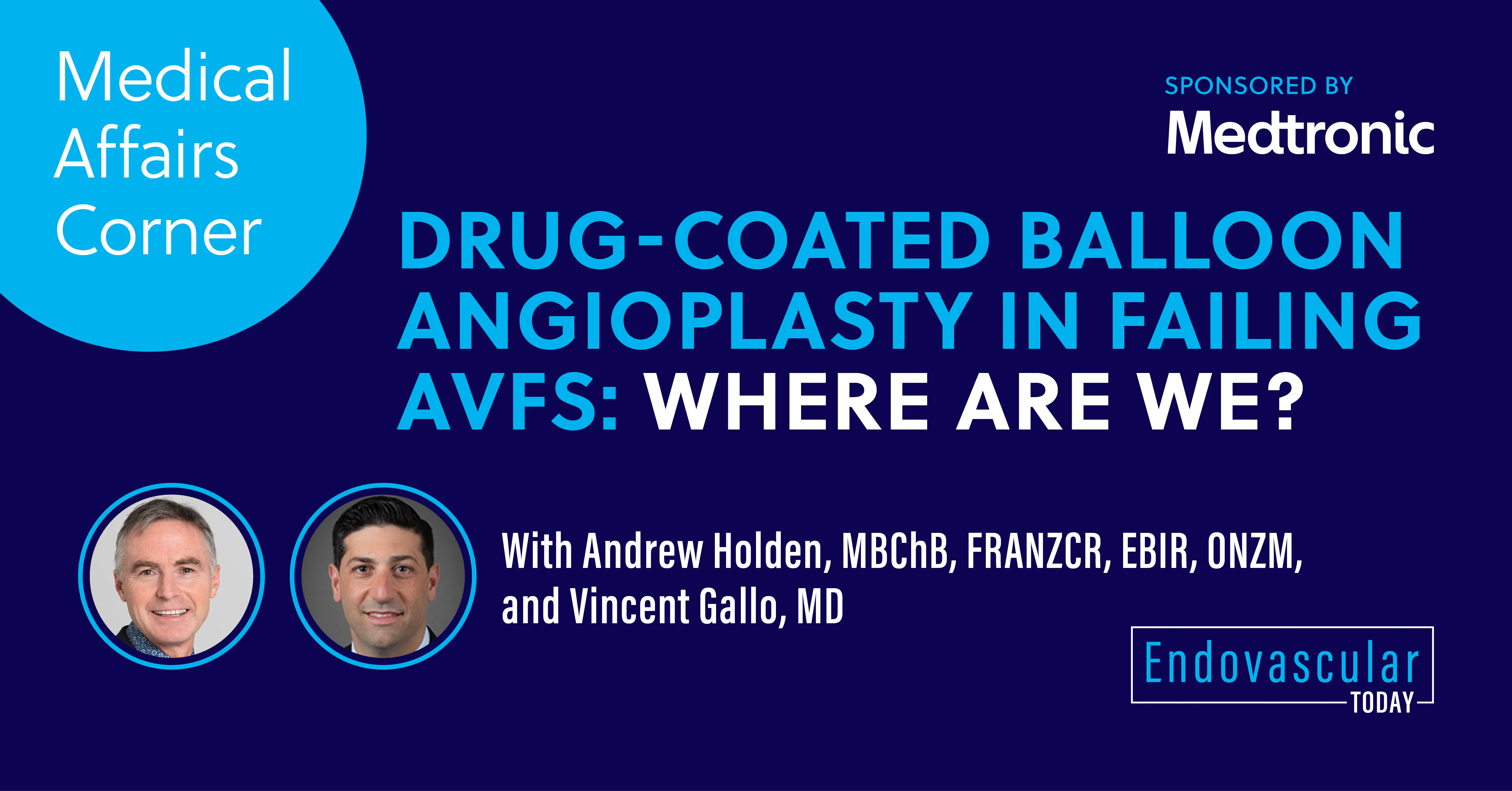 Drug-Coated Balloon Angioplasty in Failing AVFs: Where Are We? - Vimarsana News