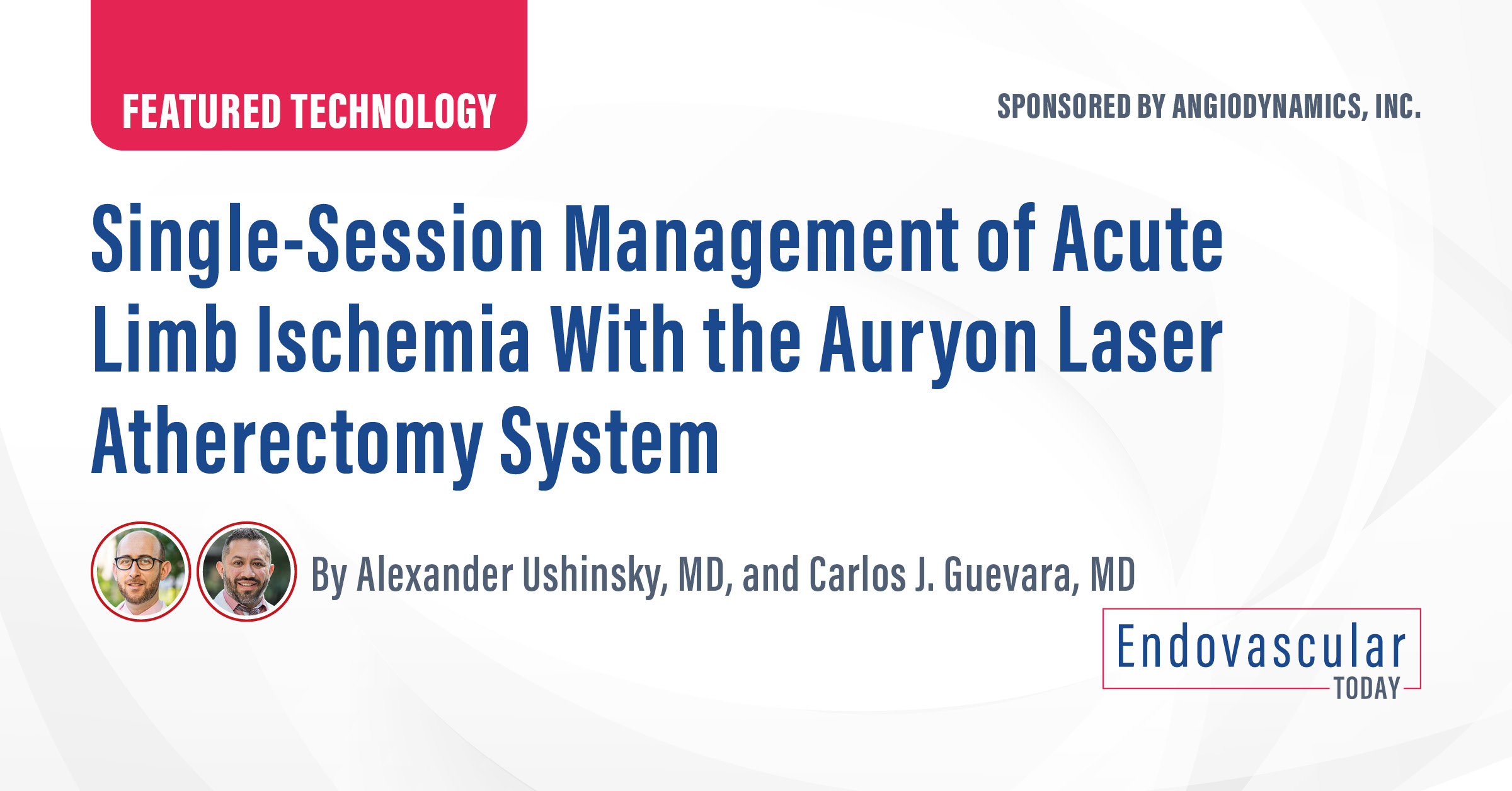 Single-Session Management Of Acute Limb Ischemia With The Auryon Laser ...