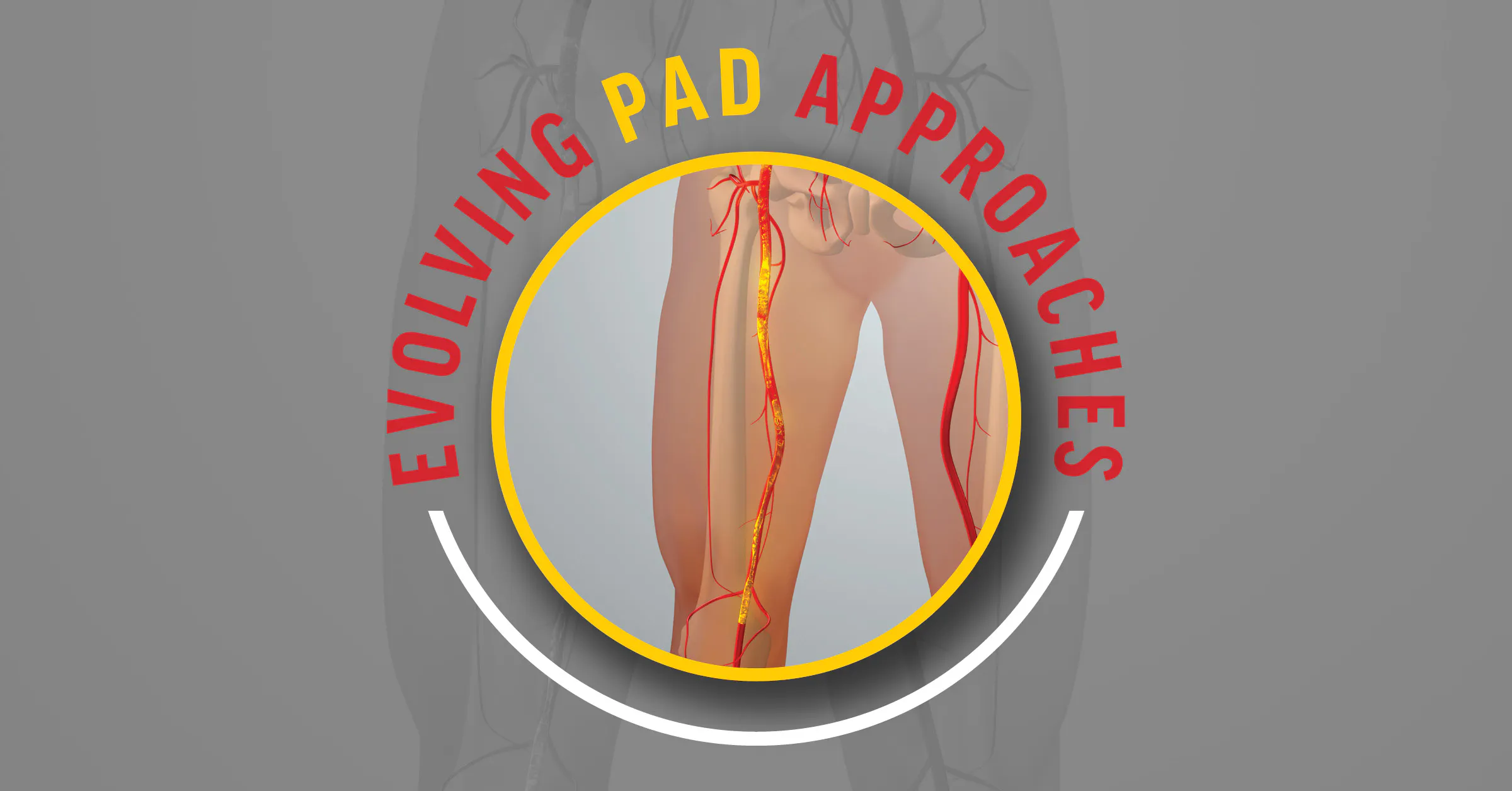 Evolving PAD Approaches - Endovascular Today