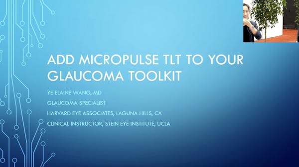 Add MicroPulse TLT to Your Glaucoma Toolkit thumbnail
