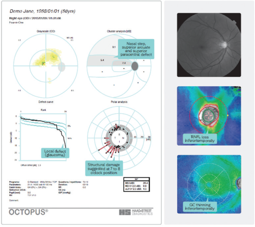 Structure and Function in Early Diagnosis Modern Optometry