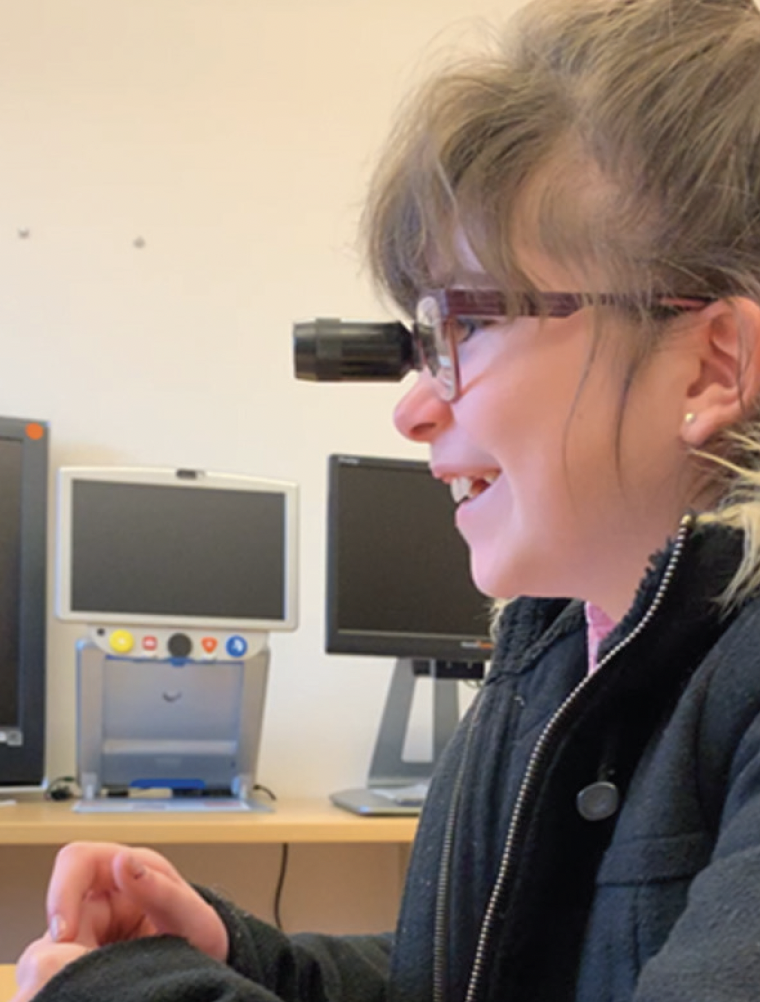 <p>Figure 2. A seventh grader fitted with a focusable 6x bioptic telescope to see the board at school.</p>