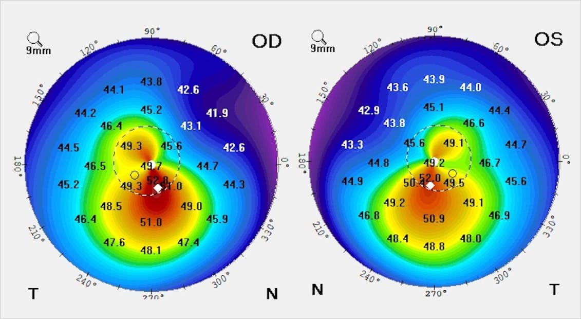 Collaborative Case #001: To Treat or Not to Treat... - Modern Optometry