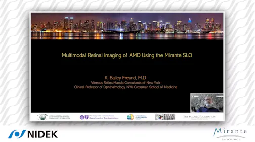 Multimodal Retinal Imaging of AMD Using the Mirante SLO