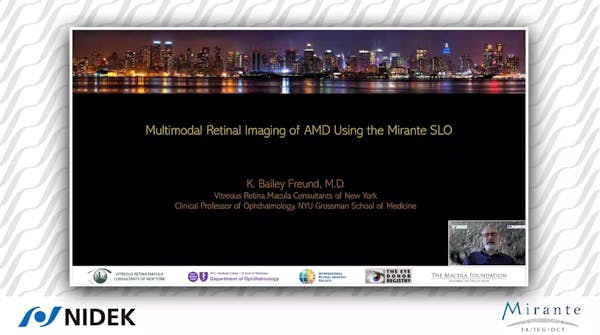 Multimodal Retinal Imaging of AMD Using the Mirante SLO thumbnail