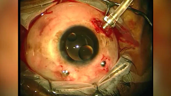 Silicone Oil thumbnail