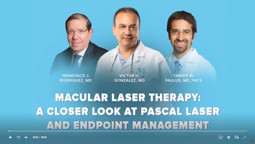 Macular Laser Therapy: A closer look at the Pascal Laser with Endpoint Management