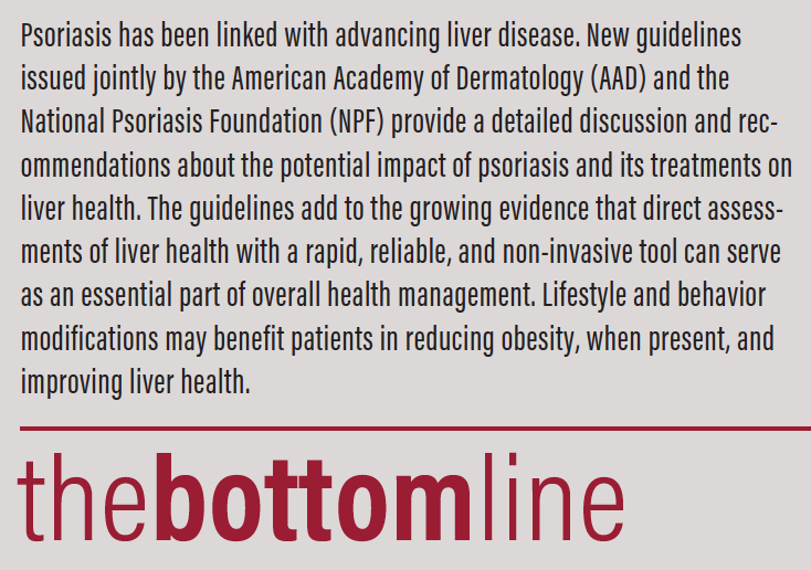 Considering Liver Health in Psoriasis New Assessment Options