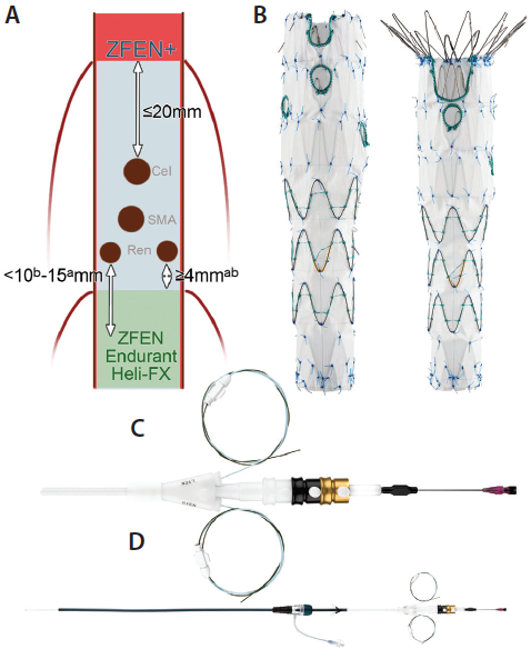 Modern Complex Stent Graft Designs A Closer Look Endovascular Today