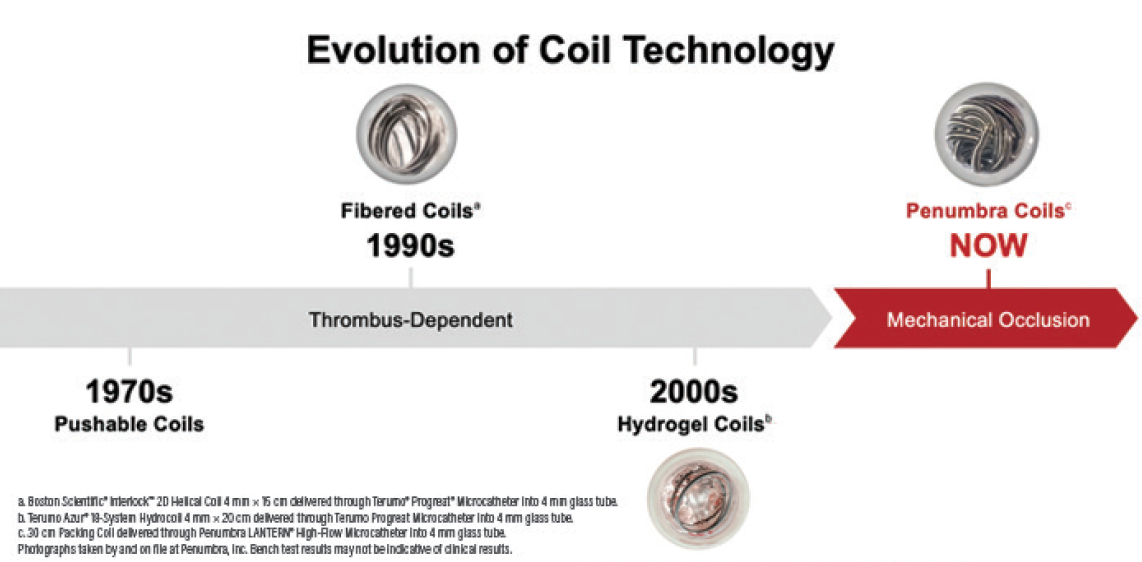 A Coil for Every Case Achieving Volume and Softness With the Penumbra