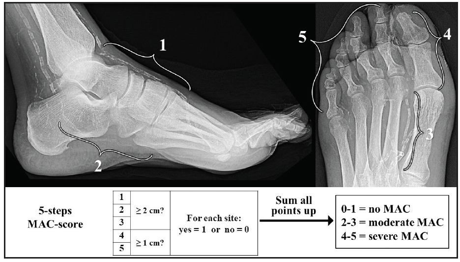 Hybrid superficial venous arterialization and endovascular deep venous  arterialization - Journal of Vascular Surgery Cases, Innovations and  Techniques