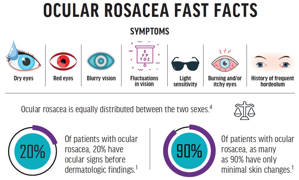 Ocular rosacea discount