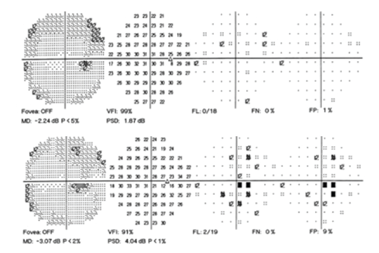 Downloadable Amsler Grid - Central Triad Retina Physicians