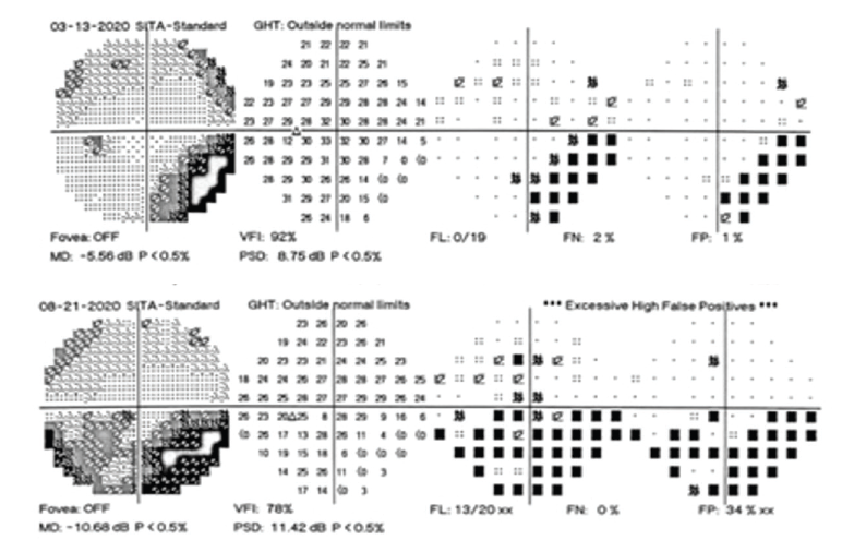 Downloadable Amsler Grid - Central Triad Retina Physicians