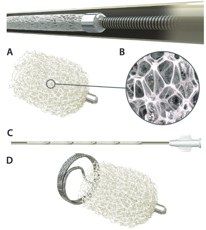 Shape Memory Polymer: A New Solution for AAA Endoleak Management
