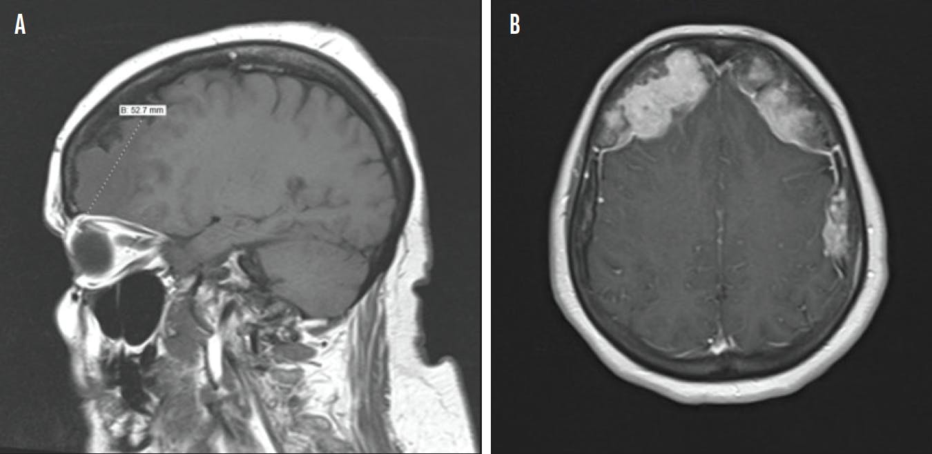 A Medical Optometrist's Guide to MRI   Modern Optometry