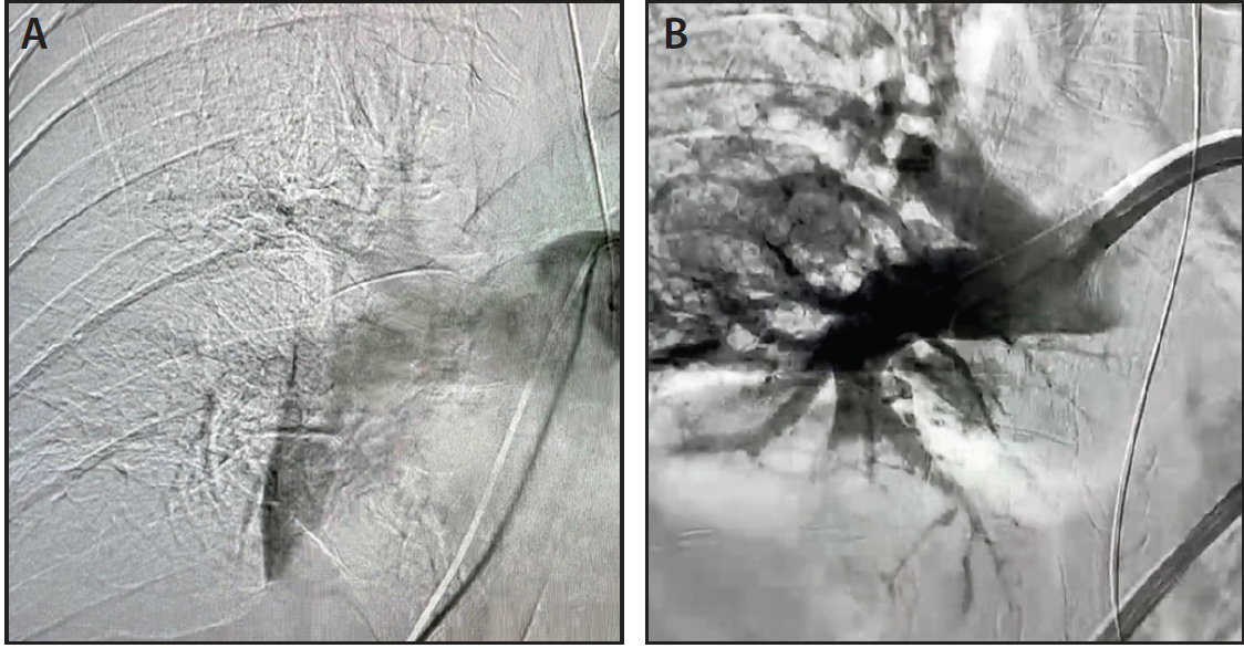 Lightning Flash™ The Most Powerful and Advanced Mechanical
