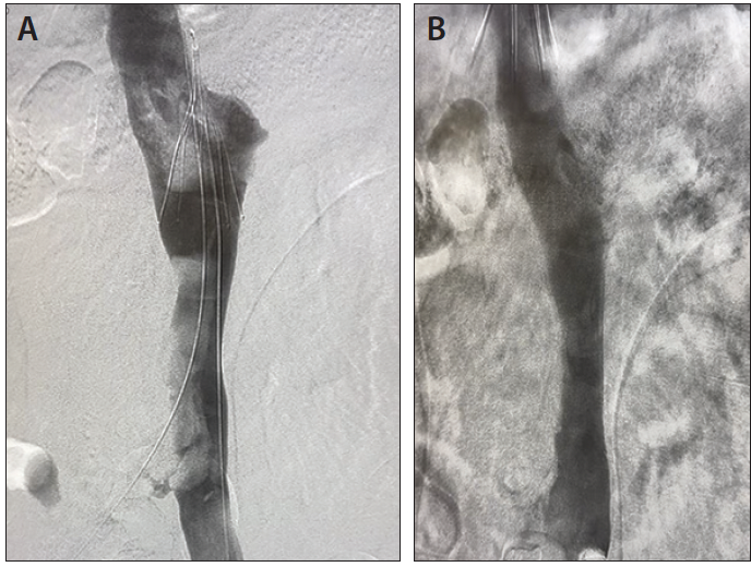 Lightning Flash™ The Most Powerful and Advanced Mechanical