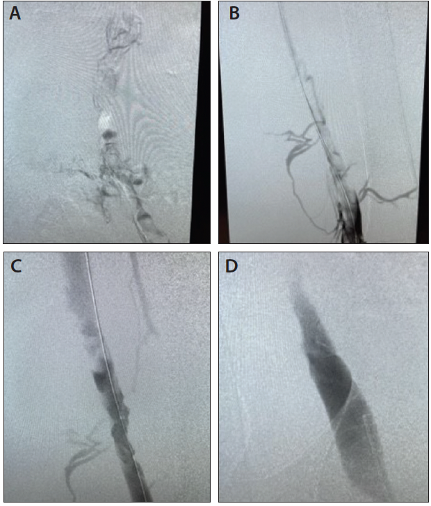 Lightning Flash™ The Most Powerful and Advanced Mechanical