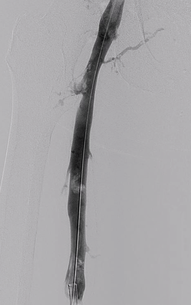 Lightning Flash™ The Most Powerful and Advanced Mechanical