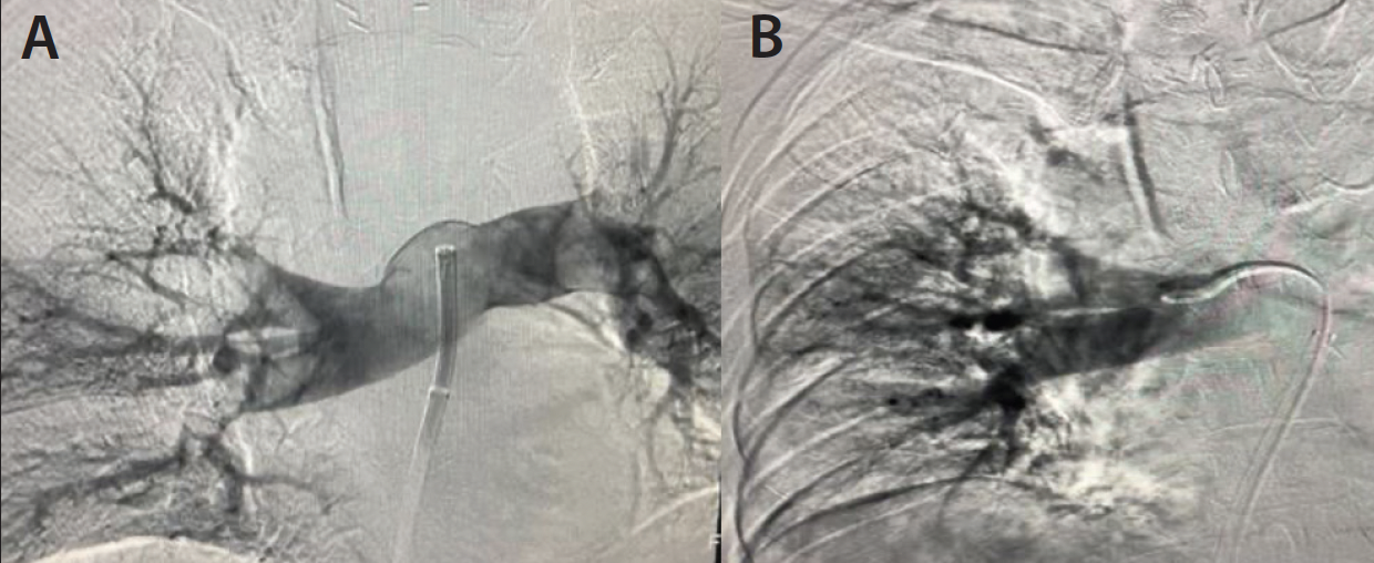 Lightning Flash™ The Most Powerful and Advanced Mechanical