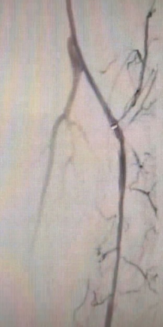 Lightning Bolt™ 7 and Lightning Flash™ The Next Generation of CAT