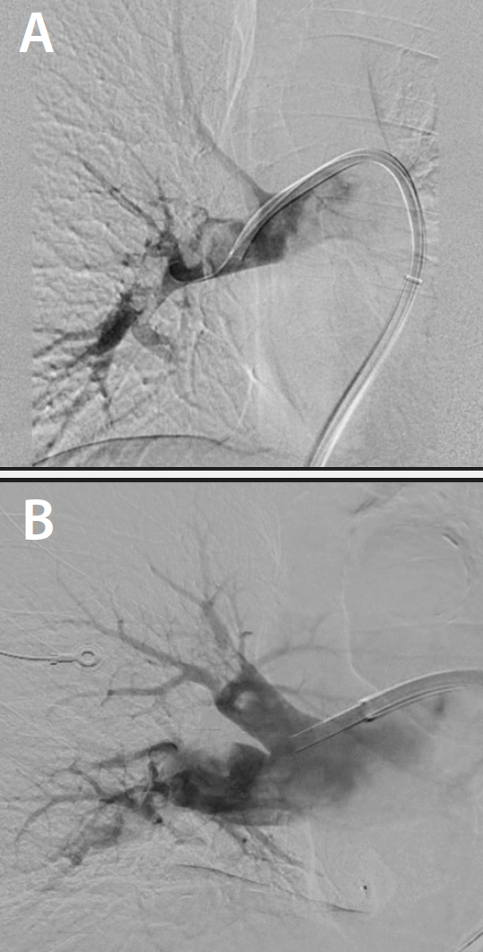 Lightning Bolt™ 7 and Lightning Flash™ The Next Generation of CAT