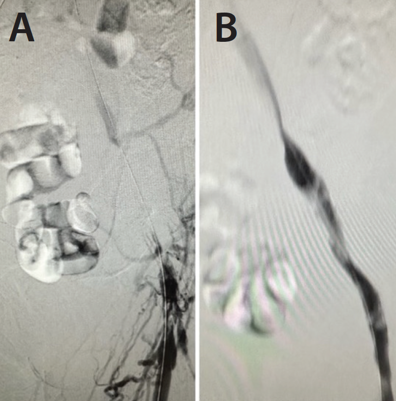 Lightning Bolt™ 7 and Lightning Flash™ The Next Generation of CAT
