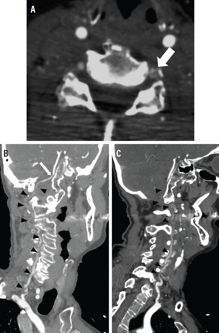 Pica, Radiology Reference Article