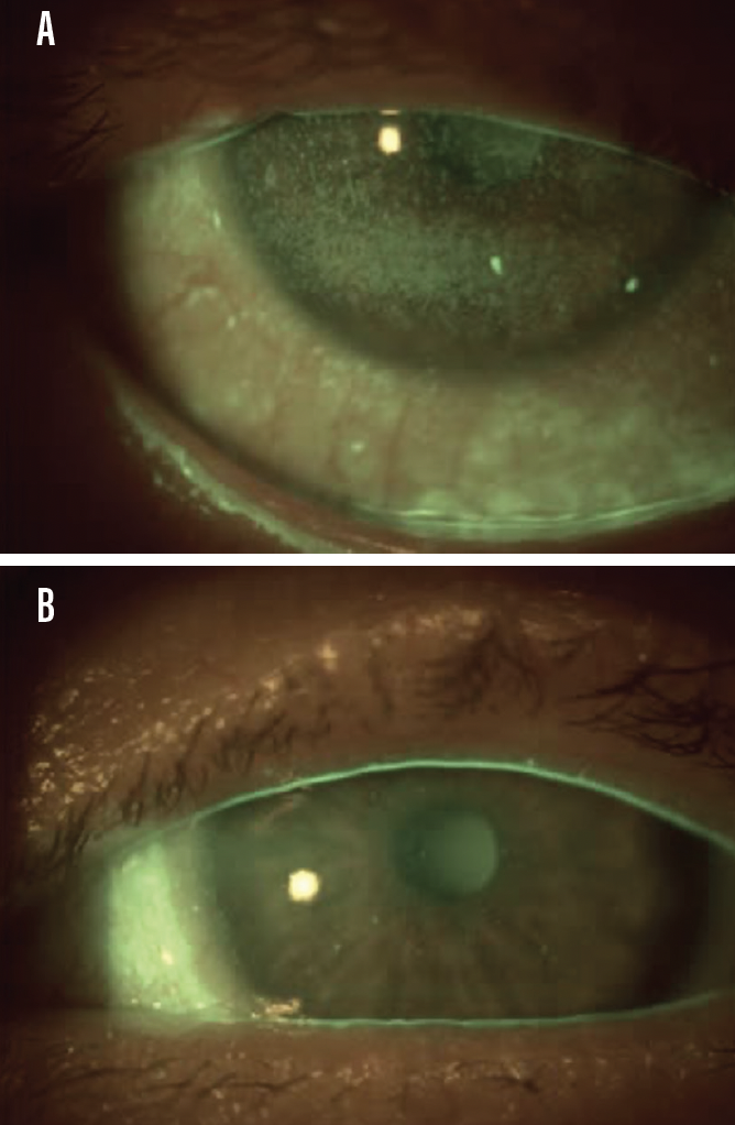 Decoding the Healing Potency of Biologics - Modern Optometry